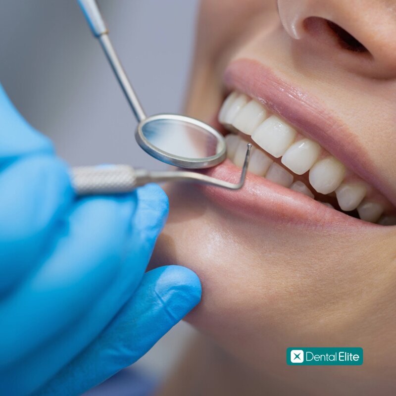 Dental Elite Dorobanti - Clinica stomatologica si implantologie
