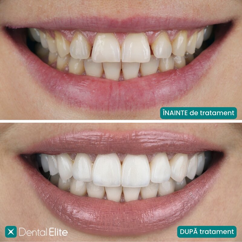 Dental Elite Dorobanti - Clinica stomatologica si implantologie